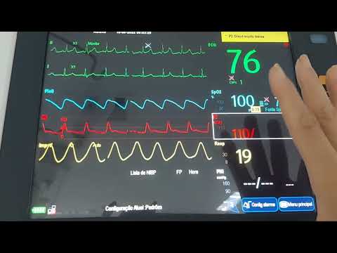 vital signs in the ICU how to do it how to understand the ICU monitor