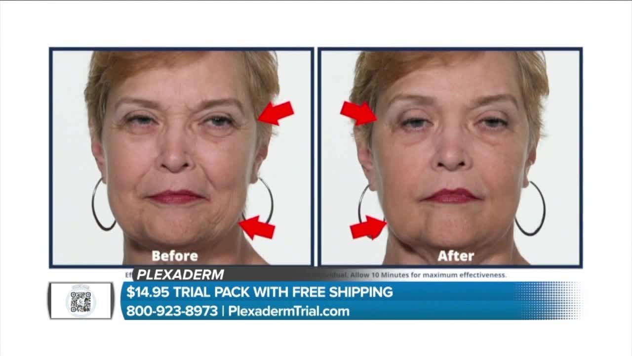 Reduce fine lines and wrinkles in seconds with Plexaderm (sponsored)