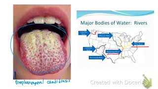 Opportunistics Infections in HIV patients