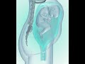 Fetus Coming In To Birth Position 3D Animation