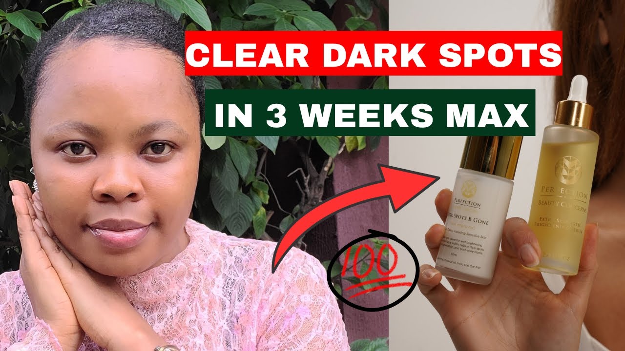 Clear Dark Spots And Pigmentation In 3 Weeks With This Face Serum 