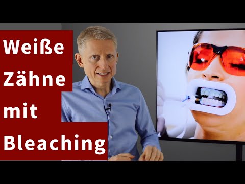 Weiße Zähne mit Bleaching - So geht Zahnaufhellung in der Praxis