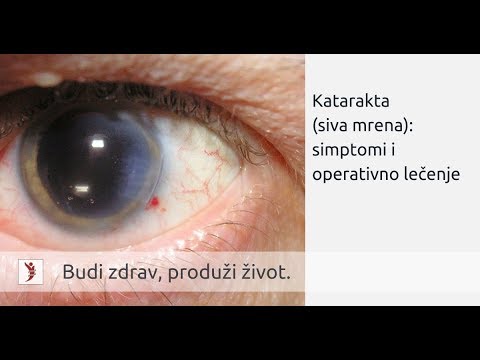 hipertenzija ir katarakta hipertenzijos gydymas netradicinėmis priemonėmis