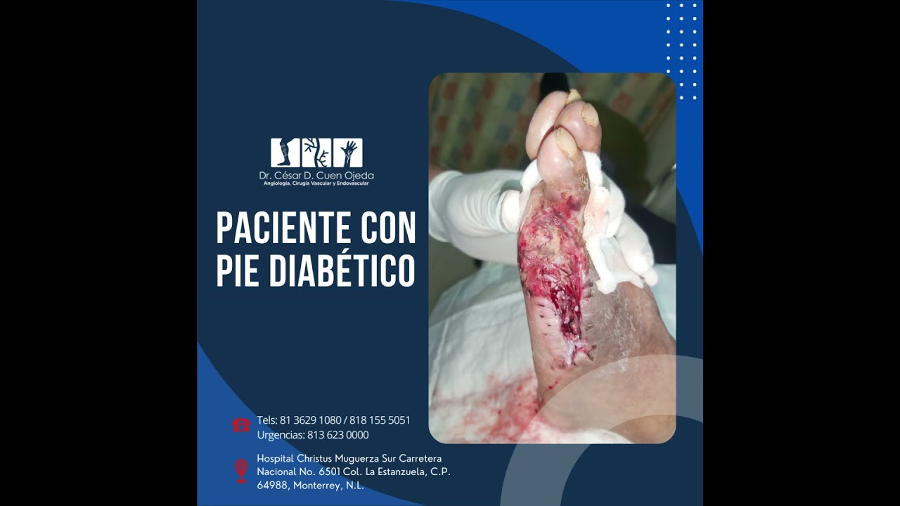 César Daniel Cuen Ojeda-23