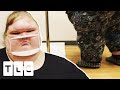 Tammy's Weight Rises Above 600lb Worrying Brother Chris | 1000-lb Sisters