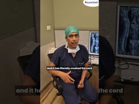 21-Year-Old Suffers Cervical Spine Injury After Pool Dive | Dr. Ajay Kothari