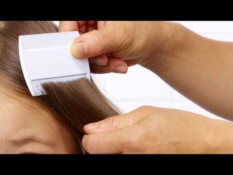 القمل Novyj Trend Smotret Onlajn Na Sajte Trendovi Ru