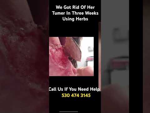 We Got Rid Of Her Tumor In Three Weeks
