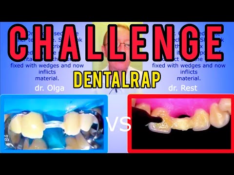 DentalRap  / Dr Olga VS Dr Rest