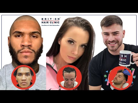 UK's Leading Hair Transplant Clinic. Amazing Results London - Manchester -Essex