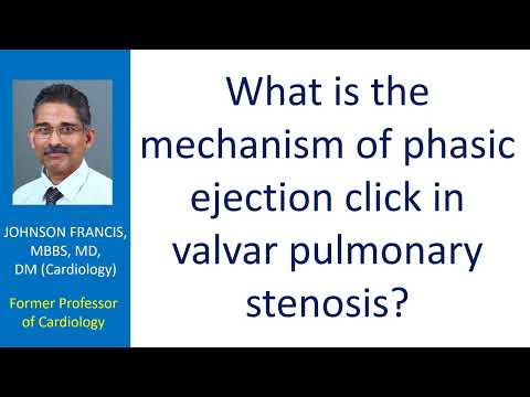 What is the mechanism of phasic ejection click in valvar pulmonary stenosis?