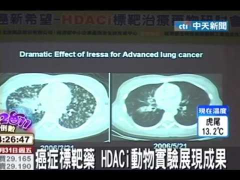 癌症標靶藥 HDACi動物實驗展現成果