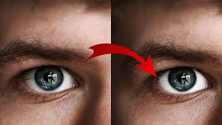 Whitening and removal of eye veins photoshop
