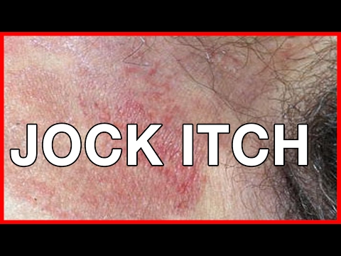 Kung ano ang maaari pagalingin halamang-singaw sa bibig Onychomycosis nail treatment Irunine