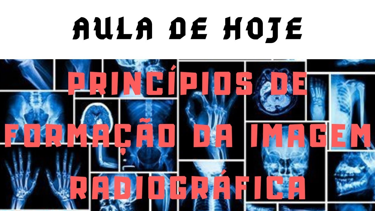 PRINCÍPIOS DE FORMAÇÃO DA IMAGEM RADIOGRÁFICA