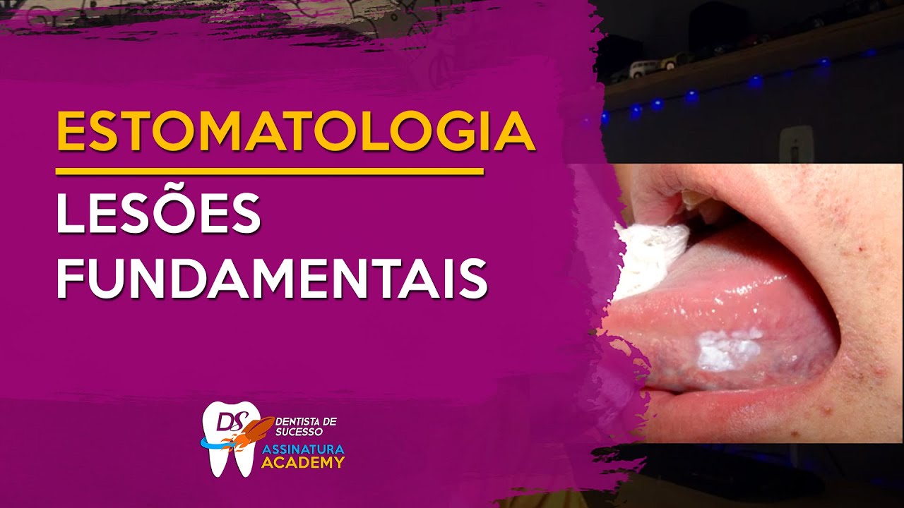 Lesões Fundamentais | ESTOMATOLOGIA