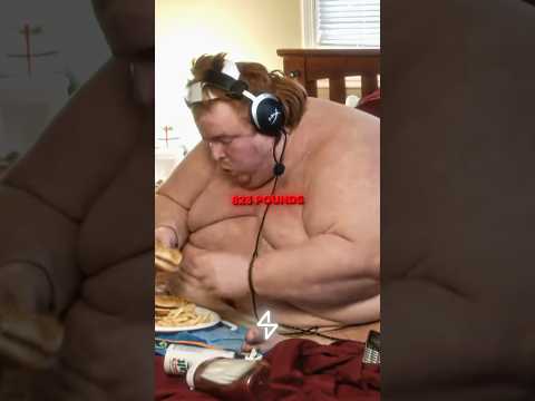 Doctors Told Him It Wasn't Possible... Then He Lost 500 Pounds🥶