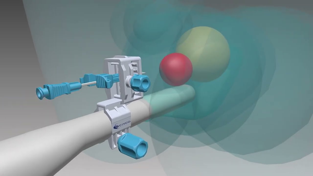 The Smarter Approach to Transperineal Biopsies