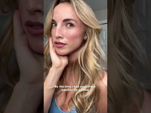 My Honest Lumi Super Patch Review Before a Big Wedding