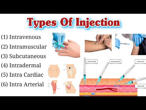 IV Cannula Colour And Size Cannula Types And Uses