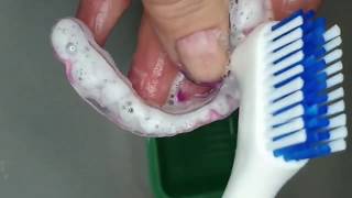 My Orthodontic Adventure - Cleaning Aligners