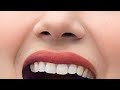 Actress Parul Gulati Nose Hole And Lips Closeup Ultra Zoom