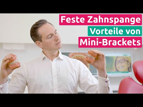 Mini-Brackets - Was ist der Unterschied zu den normalen Brackets - KFO1 - Praxis Dr. Schmidt