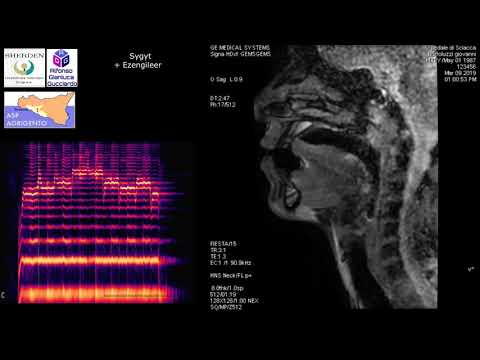 FIESTA IMAGING VIDEO EXTRACTS: Canto Difonico/Overtone singing in MRI