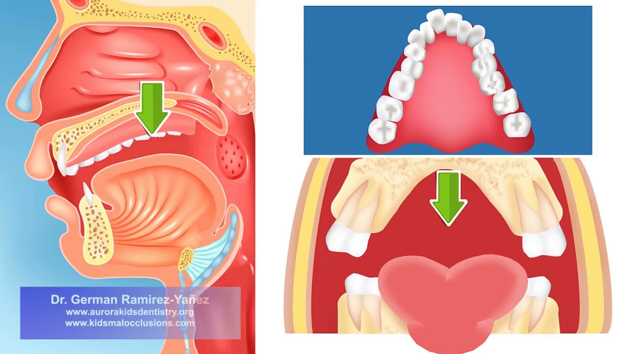 Coral Guillén López-17