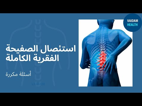 الأسئلة المتداولة حول استئصال الصفيحة الفقرية