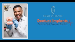 Denture Implants - What Are Their Types and Benefits?