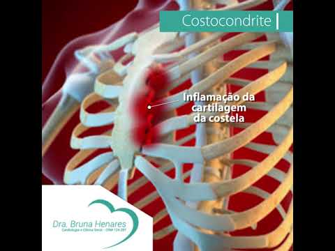 Apesar de poucos conhecerem o termo técnico “Costocondrite”, muitos já tiveram!⁣