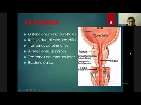 Prostatitis és ureoplazma