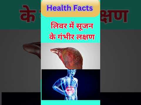 लिवर में सूजन के गंभीर लक्षण Liver Swelling #shorts #shortsfeed #ytshorts