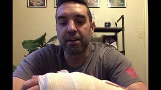 Scapholunate (SL) Ligament Reconstruction with Arthrex - Day 1