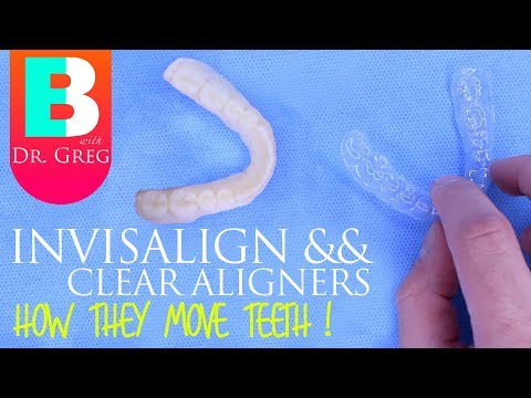 How Invisalign Works // How Clear Aligners Work