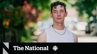 What it’s like to recover from monkeypox