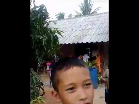 ฉับพลันกลากทารก โรคสะเก็ดเงินที่เล็บ akriderm