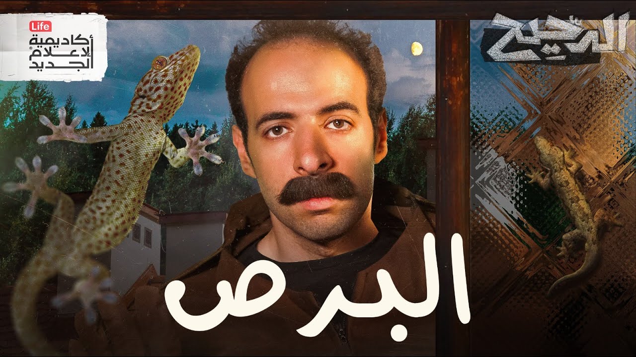 البرص | الدحيح