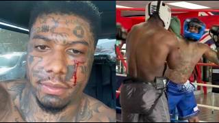 Blueface Shows His Black Eye After Sparring Match Goes Left