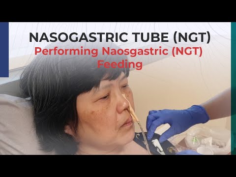 Durchführung der nasogastralen (NGT) Ernährung