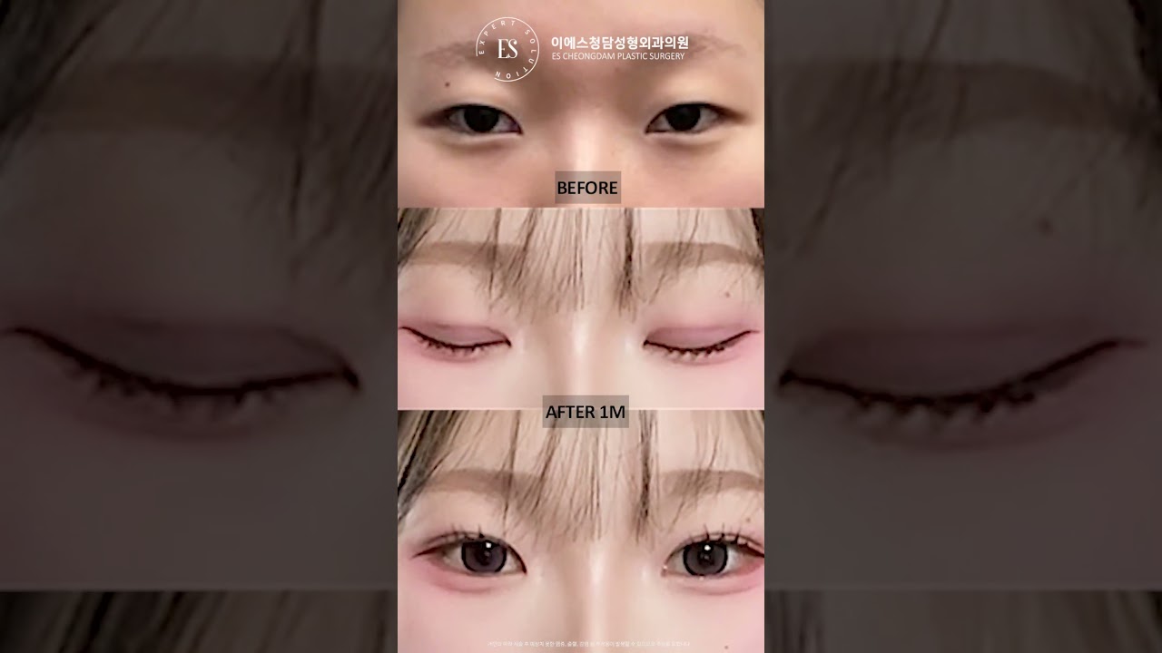 이에스 유튜브