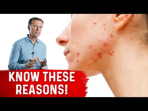 The Unique Benefits of Zinc Dr Berg Explains It s Vital Importance