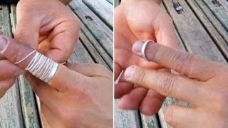 Amazing trick to remove a ring that is stuck on your finger