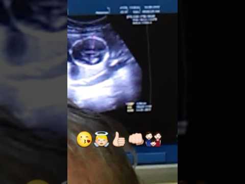 Jadiel martinez roman