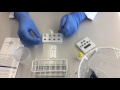 CRP Test