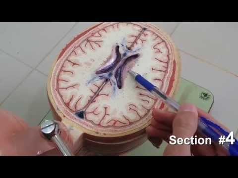 Brain Sections UPDATED