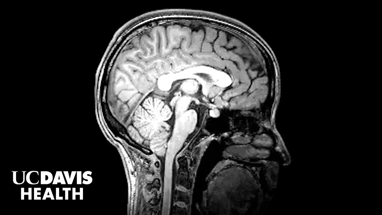 Thumbnail preview of    0:01 / 2:09  Study Finds Autistic Girls and Boys Show Key Differences in Brain Development