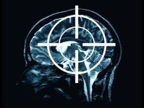 Robert Duncan Exposes Remote Neural Monitoring Mind Control