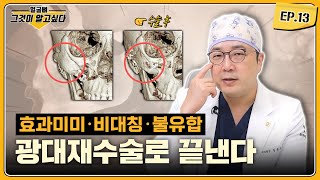 [얼굴뼈 그알] 광대재수술의 3가지 주요 원인과 해결책｜1%성형외과  #임종우 #윤곽수술 #일퍼센트성형외과